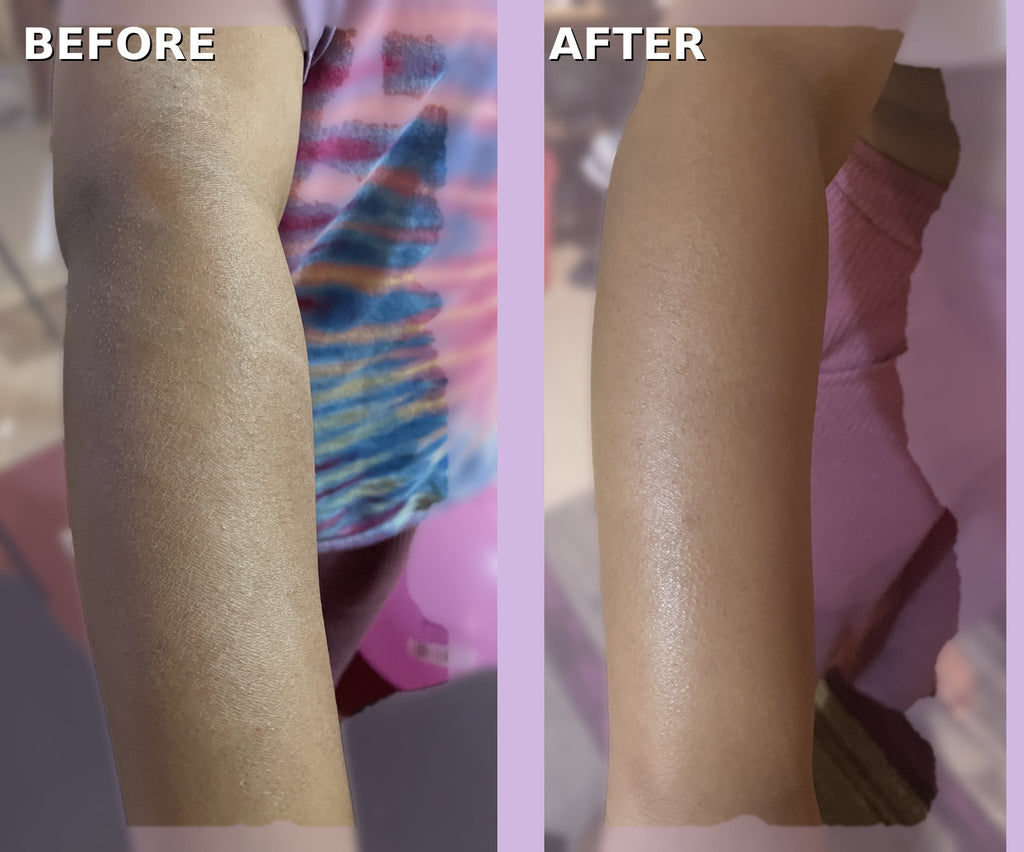 Before and after comparison of a person's arm with a visible difference in skin texture and color.